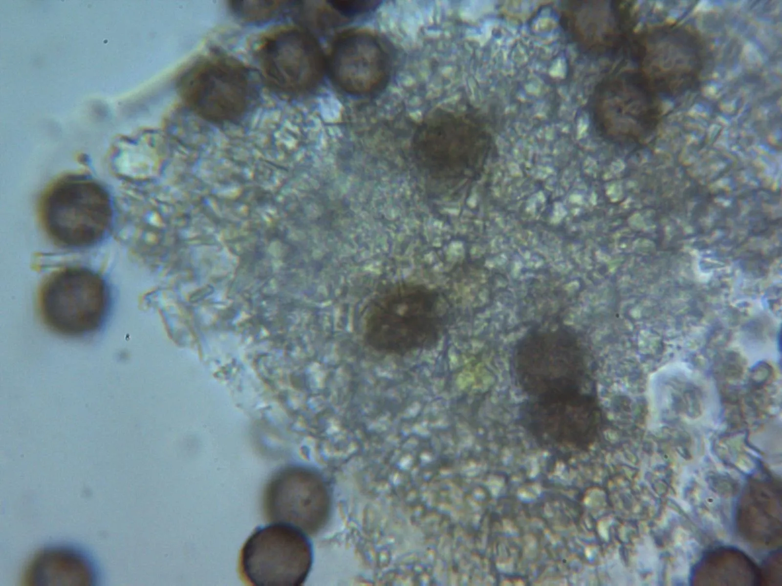 Microscopía de Physarum cinereum - 10 - Membrana 4 agua